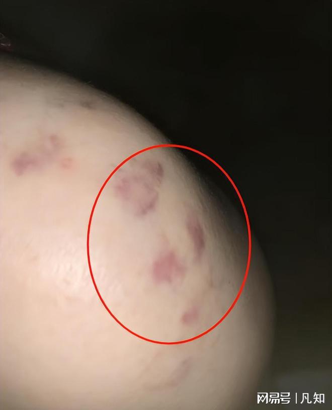 亲暴打后续已回学校并拉黑父亲以后靠自己pg电子模拟器试玩窒息！女孩正月被父(图4)